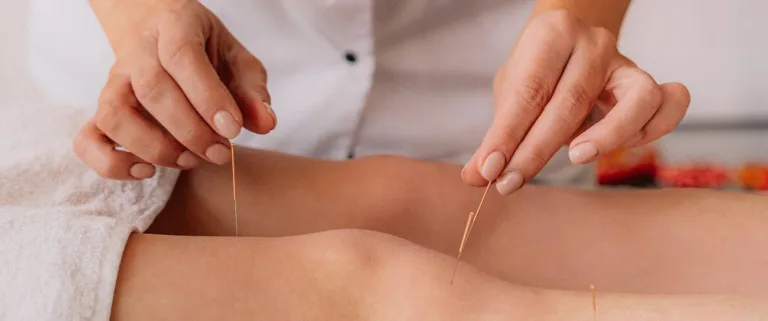 Acupuncture for Stress and Anxiety: A Complete Guide